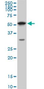 AKT1 Antibody in Western Blot (WB)