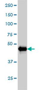 AKT2 Antibody in Western Blot (WB)