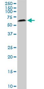 AKT2 Antibody in Western Blot (WB)