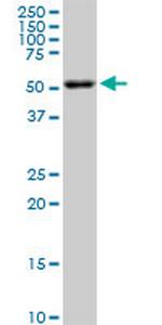 AKT2 Antibody in Western Blot (WB)