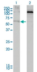 ALAS2 Antibody in Western Blot (WB)