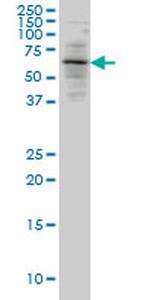 ALAS2 Antibody in Western Blot (WB)