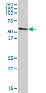 ALDH1A1 Antibody in Western Blot (WB)