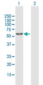 ALDH1A1 Antibody in Western Blot (WB)