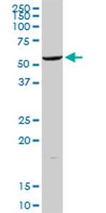 ALDH2 Antibody in Western Blot (WB)