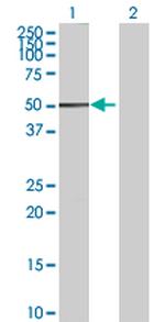 ALDH2 Antibody in Western Blot (WB)