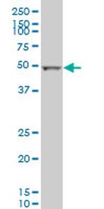 ALDH2 Antibody in Western Blot (WB)