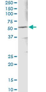 ALDH3A1 Antibody in Immunoprecipitation (IP)