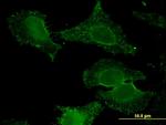 ALDH9A1 Antibody in Immunocytochemistry (ICC/IF)