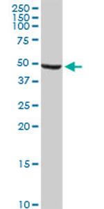 ALDH9A1 Antibody in Western Blot (WB)