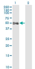 ALDH9A1 Antibody in Western Blot (WB)