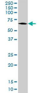 ALDH9A1 Antibody in Western Blot (WB)