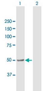 ALDH3A2 Antibody in Western Blot (WB)