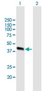 ALDOB Antibody in Western Blot (WB)