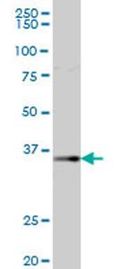 AKR1B1 Antibody in Western Blot (WB)