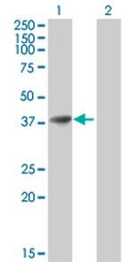 AKR1B1 Antibody in Western Blot (WB)