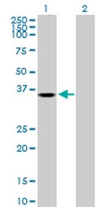 AKR1B1 Antibody in Western Blot (WB)