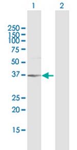 AKR1B1 Antibody in Western Blot (WB)