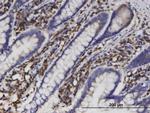 AKR1B1 Antibody in Immunohistochemistry (Paraffin) (IHC (P))