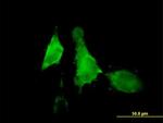 ALOX12 Antibody in Immunocytochemistry (ICC/IF)