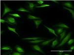 ALOX15B Antibody in Immunocytochemistry (ICC/IF)