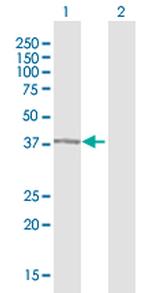 AMBP Antibody in Western Blot (WB)