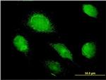 AMBP Antibody in Immunocytochemistry (ICC/IF)