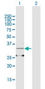 AMD1 Antibody in Western Blot (WB)