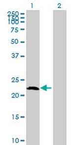 AMELX Antibody in Western Blot (WB)