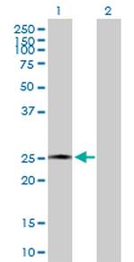 AMELX Antibody in Western Blot (WB)