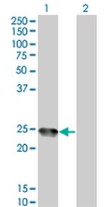 AMELX Antibody in Western Blot (WB)