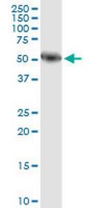 AMY1A Antibody in Western Blot (WB)