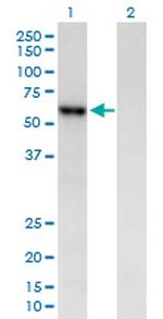 AMY2B Antibody in Western Blot (WB)