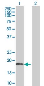 ANK1 Antibody in Western Blot (WB)