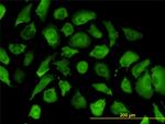 ANXA2 Antibody in Immunocytochemistry (ICC/IF)