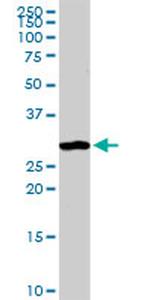 ANXA4 Antibody in Western Blot (WB)