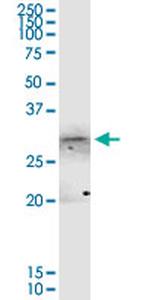 ANXA4 Antibody in Western Blot (WB)