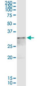 ANXA4 Antibody in Western Blot (WB)