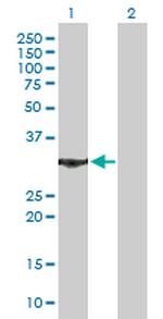 ANXA5 Antibody in Western Blot (WB)