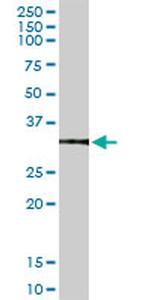 ANXA5 Antibody in Western Blot (WB)