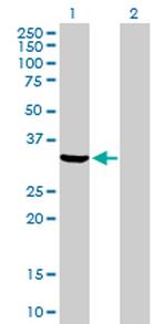 ANXA5 Antibody in Western Blot (WB)