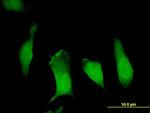 APBB1 Antibody in Immunocytochemistry (ICC/IF)