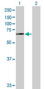 BIRC2 Antibody in Western Blot (WB)