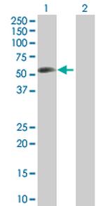 BIRC4 Antibody in Western Blot (WB)