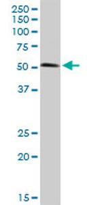 BIRC4 Antibody in Western Blot (WB)