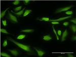 BIRC4 Antibody in Immunocytochemistry (ICC/IF)