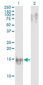 APOB Antibody in Western Blot (WB)