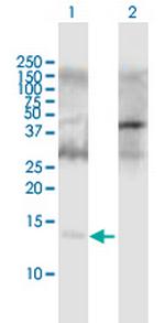 APOC2 Antibody in Western Blot (WB)