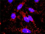 FAS Antibody in Proximity Ligation Assay (PLA) (PLA)