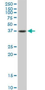 FAS Antibody in Western Blot (WB)